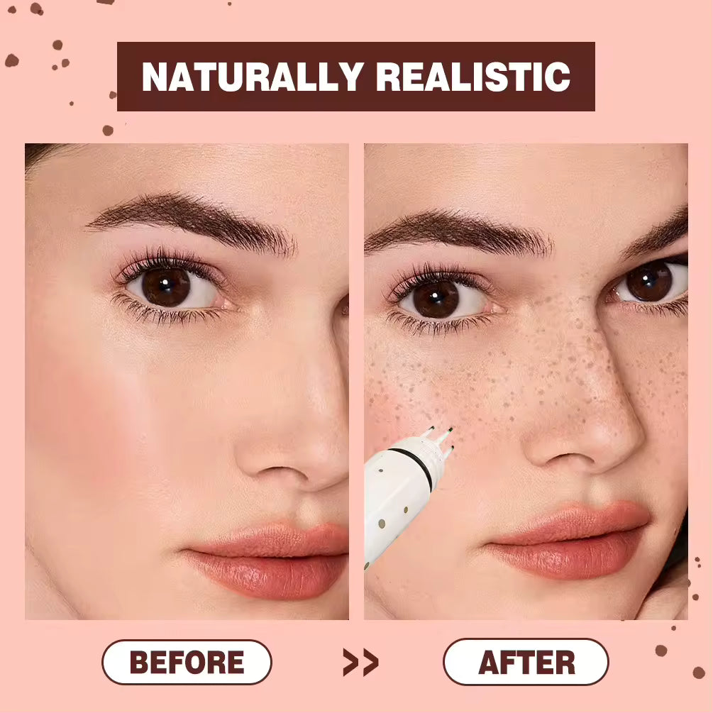 قلم النمش - PREMIUM QUALITY ✨